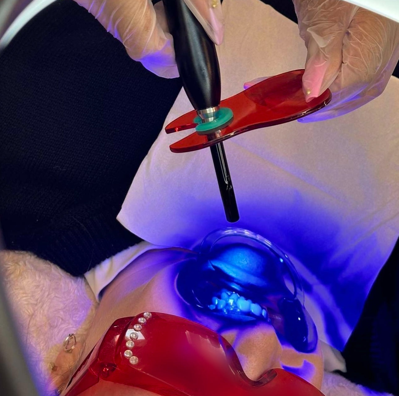 Formation à la pose de strass dentaires (SANS KIT) - Dolly Gems